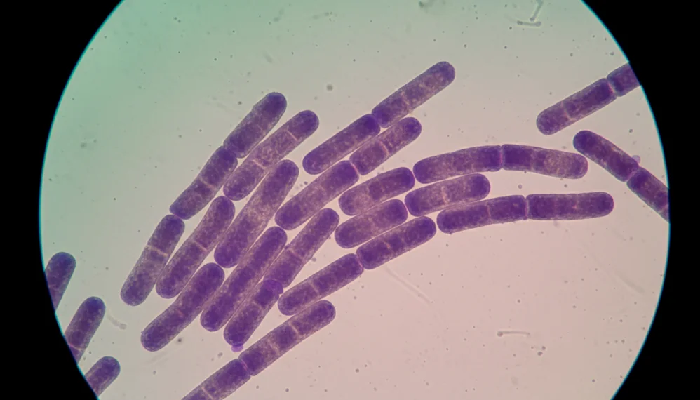 Alte infectii cutanate Alte infectii cutanate