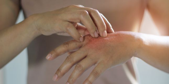 Boli ce se pot corela cu artrita Boli ce se pot corela cu artrita