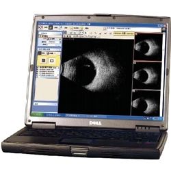 SC 2100 I A/B SCAN USB 