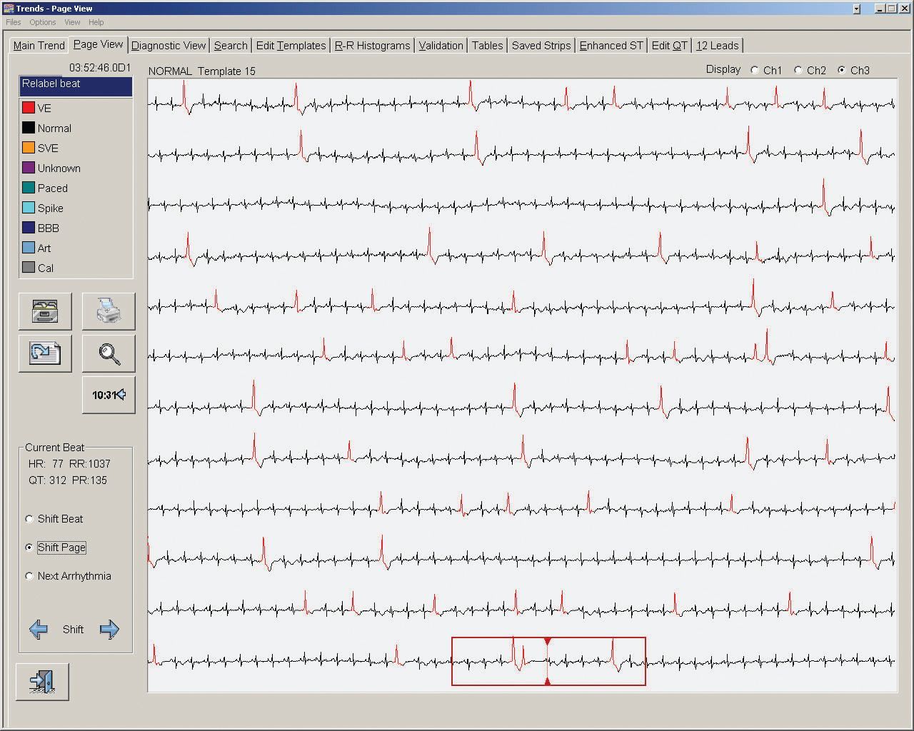 Sistem analiza Century 1000 pentru holtere