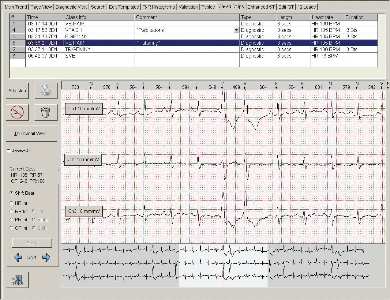 Sistem analiza Century 3000 pentru holtere