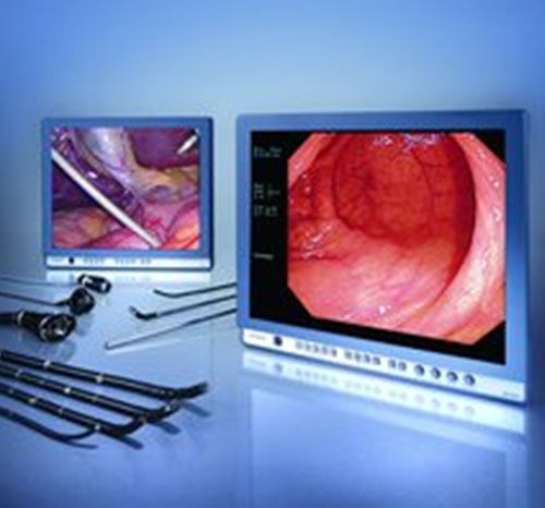 Monitoare oev 191h/191