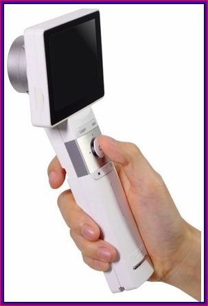 Video dermatoscop medimaging horus