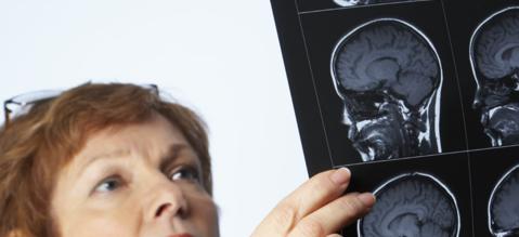 Neuropatii