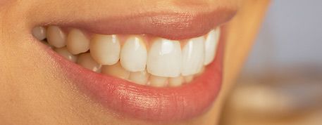 Estetica dentara