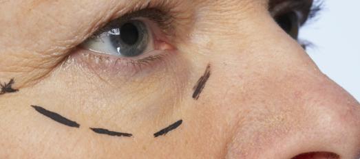 Chirurgie plastica reparatorie