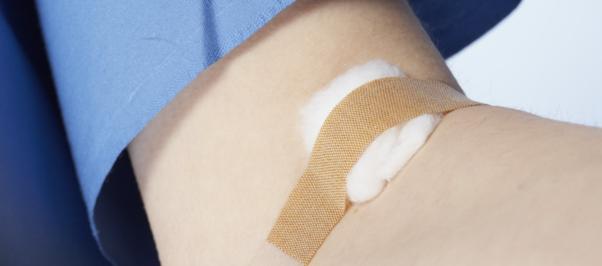 Infectia cu HIV