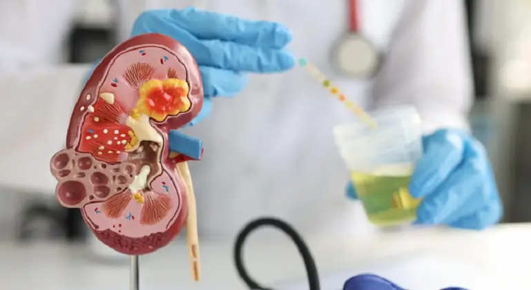 Leucinoza, o tulburare metabolica rar intalnita