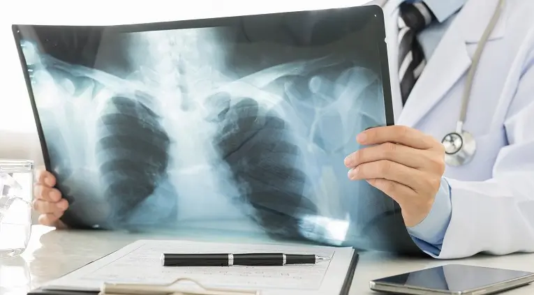 Bolile pulmonare rare