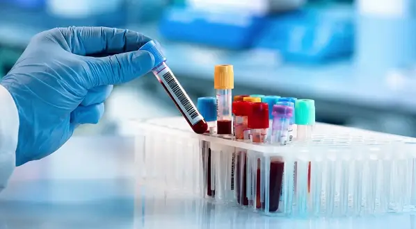 Riscul de cancer pancreatic detectat mai rapid