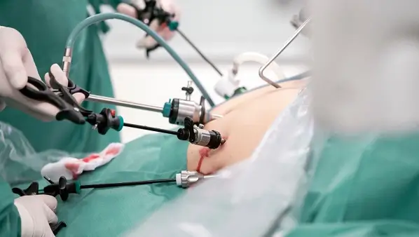 Chirurgia bariatrica - cum pot fi reduse riscurile cardiovasculare