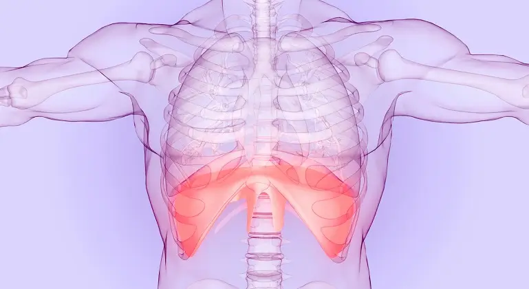 Hernia diafragmatica
