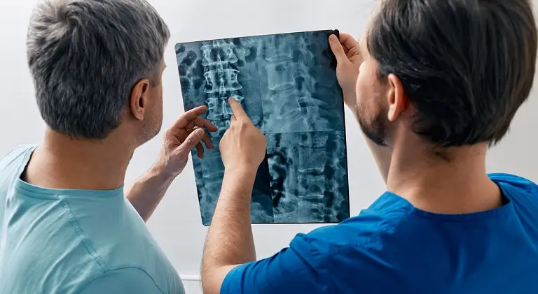 Infarctul spinal - cauze, tratament, riscuri si complicatii