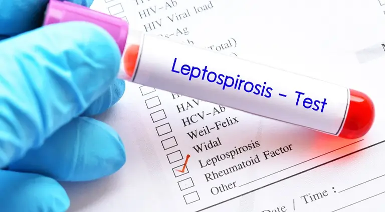 Leptospiroza: cauze si tratament