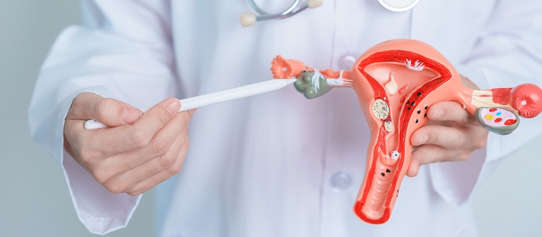 Ce este salpingita cronica si cum o tratam