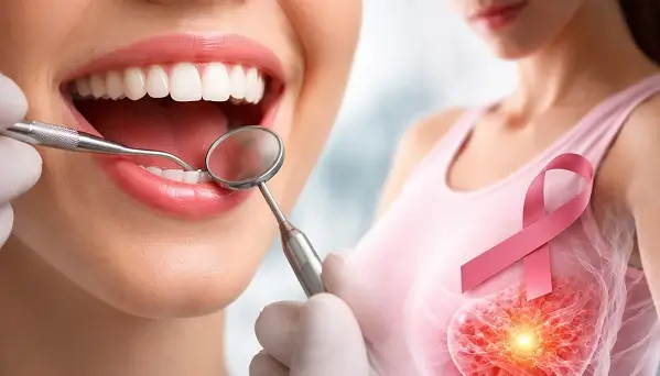 Ce legatura au bolile gingivale cu cancerul de san?