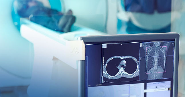Caror pacienti li se recomanda examinarea Computer Tomograf (CT) dupa infectia COVID-19? 