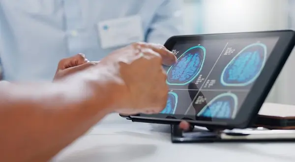 Epilepsia si riscul de moarte subita - ce trebuie sa stie pacientii si medicii