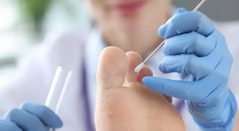 Ghid complet pentru gestionarea eficienta a infectiilor fungice ale unghiilor