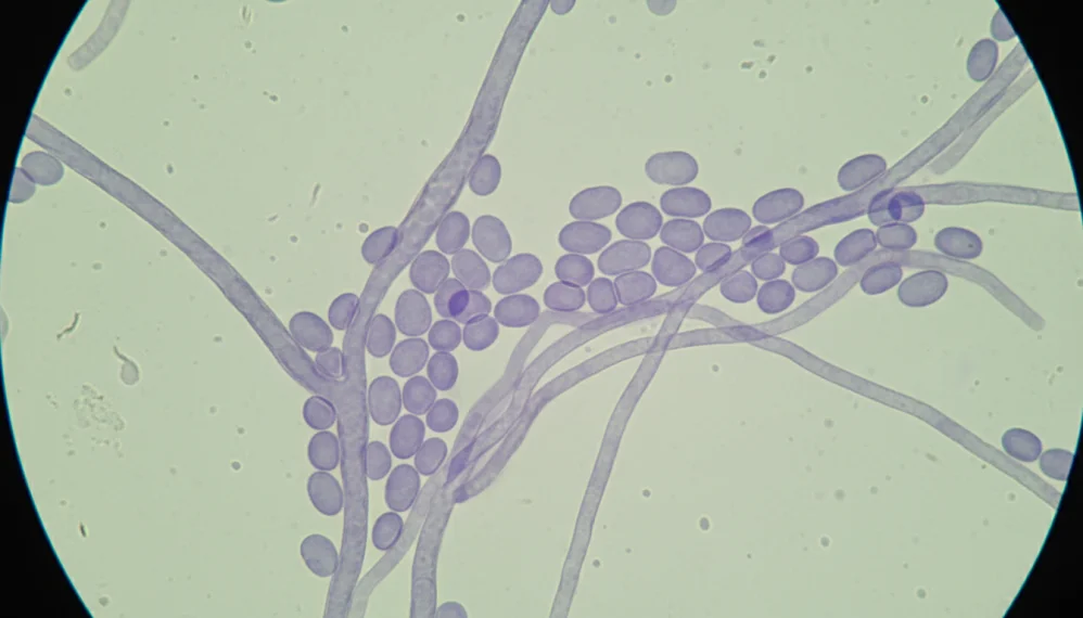 Candida tropicalis