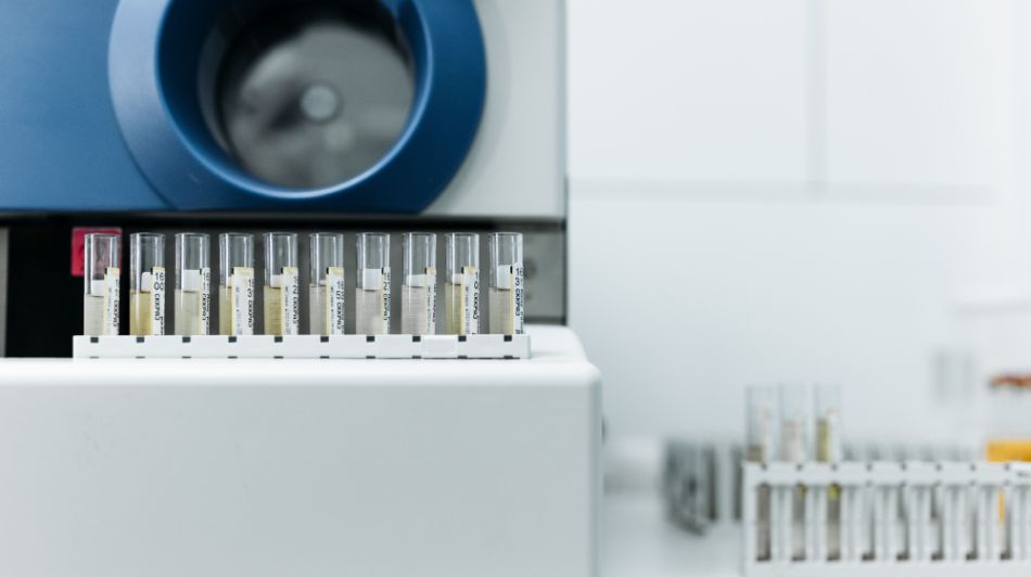 Colesterol HDL vs LDL: diferente, valori normale si cum le echilibrezi