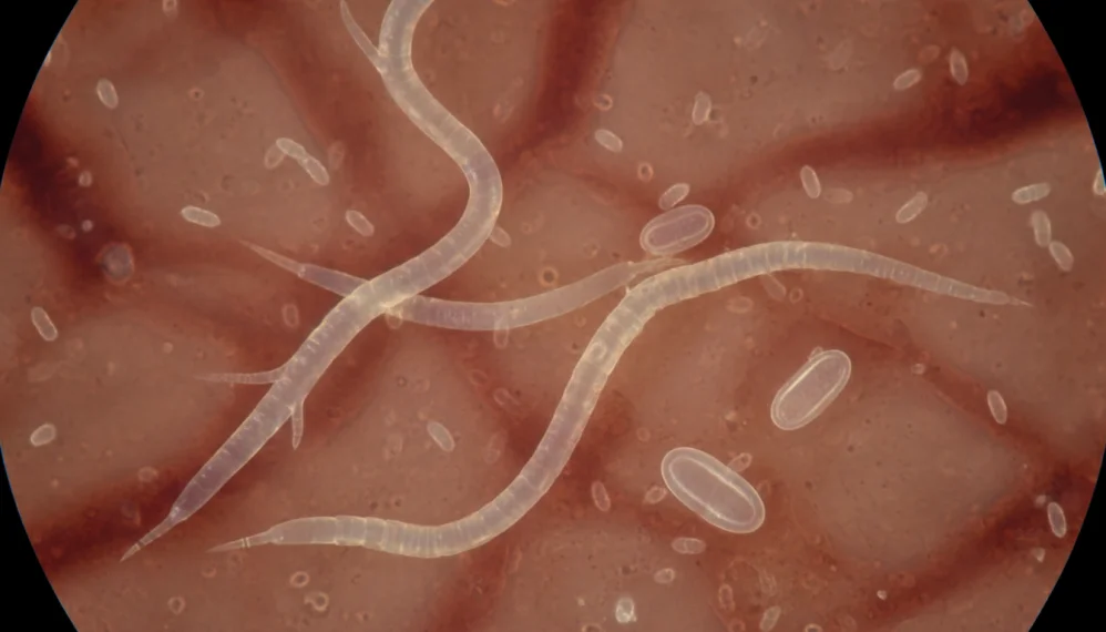 Enterobius vermicularis (oxiurii)