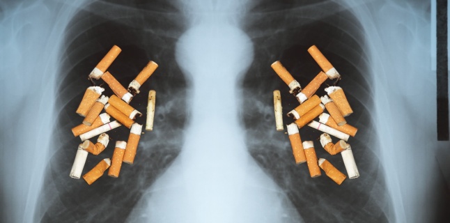 Legatura dintre fumat si riscul aparitiei cancerului