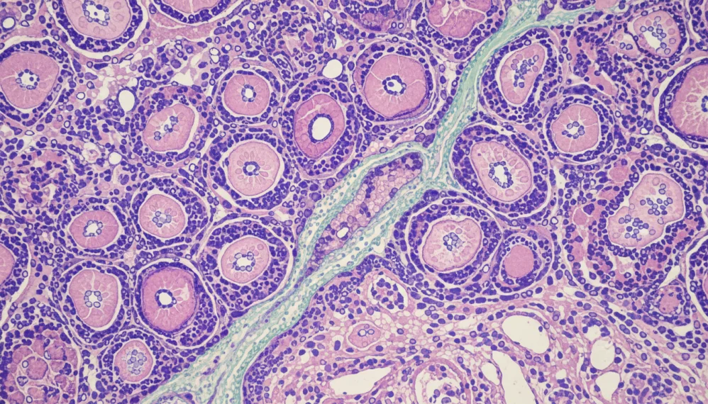 Bolile hepatice