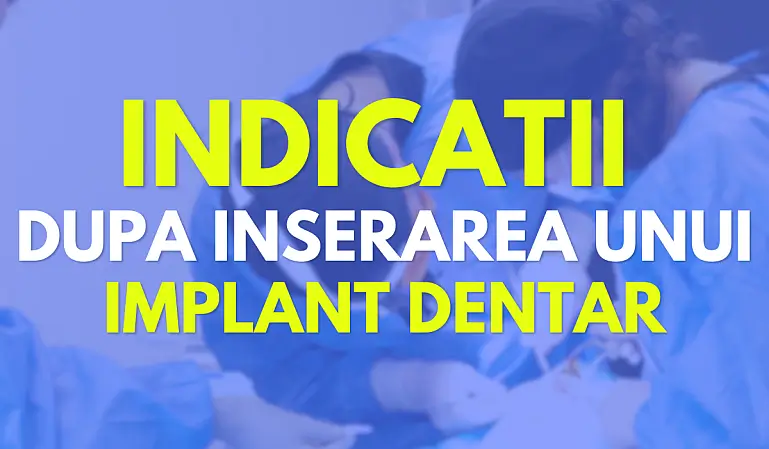 Indicatii dupa inserarea unui implant dentar