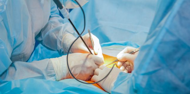 Laparoscopia ca interventie in tratamentul infertilitatii