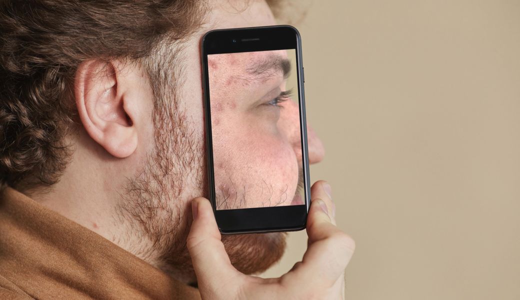 Analiza digitala a pielii devine tot mai populara in personalizarea rutinelor de skincare