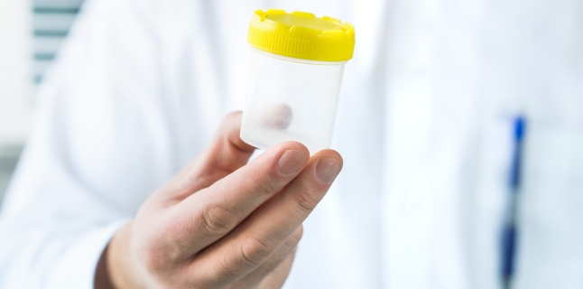 Spermograma: utilizari, procedura si rezultate
