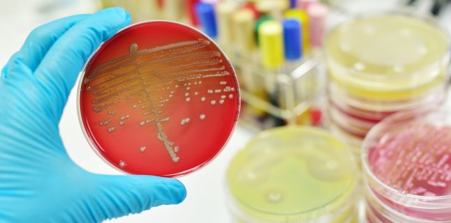 Cauze frecvente ale infectiilor rino-sinusale